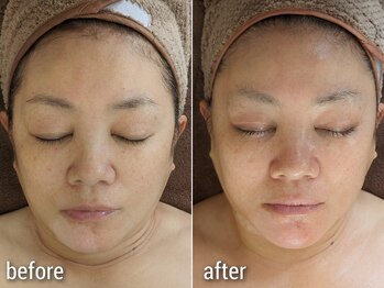 ミューク 自由が丘(mjuk)の写真/シミしわ改善&たるみケアが叶うセルラム導入♪あなたの悩みに合わせたオーダーメイド施術で効果実感☆