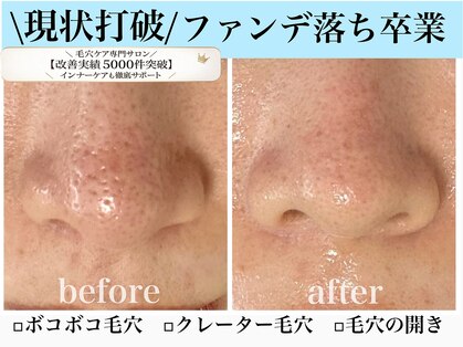 エミナル(eminal)の写真