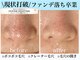 エミナル(eminal)の写真