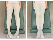 大川カイロプラクティックセンター 国立整体院/産後骨盤矯正×腰痛/BeforeAfter