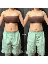 ヒヨリ(hiyori)/《before/after》body