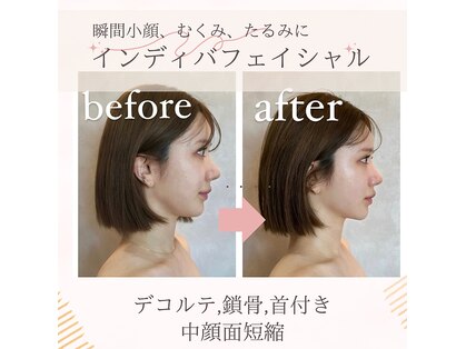 ナルシス(Narcissus)の写真