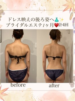 マージェ(magie)/ブライダルエステ