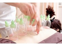 サロンメロウ 目白店(salon mellow)の雰囲気（カッピングで血流促進！腰痛/肩こり/冷え/自律神経の調整に◎）