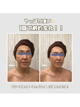 エクルビューティーツー(ECRU Beauty 2)/フォースカッターフェイシャル