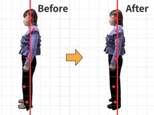 青山バランスアップ治療院の雰囲気（骨盤を矯正！腰痛、股関節の不調を改善！産前産後のケアも対応）