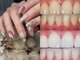 リュシオル(Luciole)の写真/【ネイル×ホワイトニング】大人気のセルフホワイトニングで透明感・清潔感のある自然な白い歯を実現！