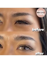 ラナ バイ アンドライフ ショウナン(Lana by andlife Shonan)/HBL ハリウッドブロウリフト