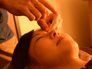 鍼灸師 かわなみこうき/鍼灸が初めての方にオススメ。