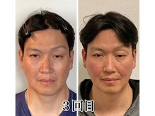 小顔22 ボルティ 赤坂支店(Bolty)/小顔シンメトリー矯正＆全身矯正