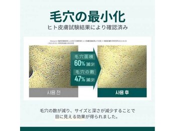 デラッセ サロン ギンザ 藤枝店(Delasser salon GINZA)/毛穴改善効能◎