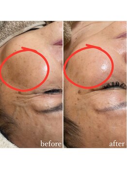 モンクラッシー(Mon classy)/2B1度目