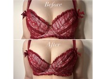 アンシャンテ(ENCHANTER)/光バストアップ