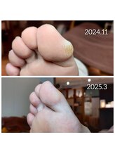 爪切り屋 足楽/