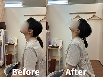 たぬきの山整骨院/首の動きがスムーズに！