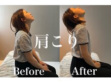 整体院ユールーム 下松店(YOUROOM)/【肩こり】