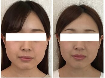 美容整体 ウェリナ 蟹江院/小顔矯正/骨盤矯正/痩身整体