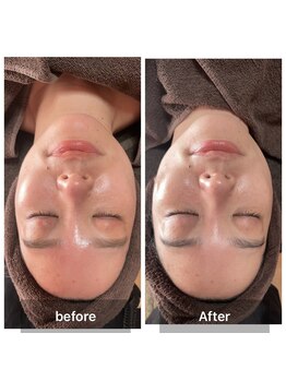 サンタ(SANTA.)/ララピール《ビフォーアフター》