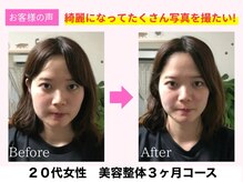 よしみち整体院/小顔矯正でリフトアップ♪