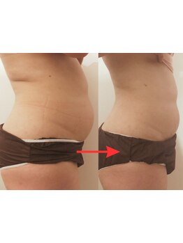 ボディラインを整えたい