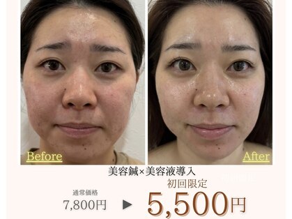 ベル(Belle)の写真