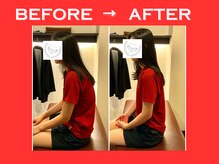 こころ整骨院/20代女性のビフォーアフター