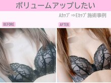ぷるるんエステ/バストケア/バストアップ/育乳