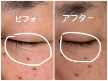 ノーブル シャット Noble Chate/印象が…目の下のくっきりシワが