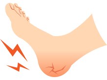 ソラ(sora)/角質除去、少しずつ定期的に◎