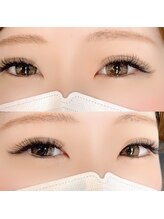 ファストラッシュ 表参道店(FAST LASH)/マツエク/LEDボリュームラッシュ