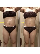 カンフリエ 吉野ヶ里店(Camphrier)/ハイパーナイフ