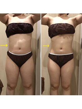 カンフリエ 吉野ヶ里店(Camphrier)/ハイパーナイフ