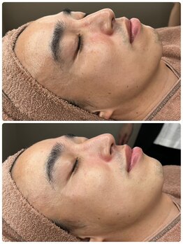 ユーイン 豊科店(U-in)/ララピールビフォーアフター