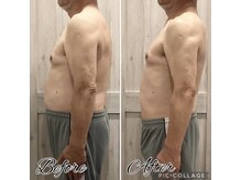 B.B藤沢 レオスタイル(LeoStyle)/NR筋膜リリースで確実に変われる