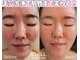 チル スキンスタジオ(CHILL skin studio)の写真
