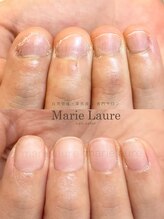 マリーロール 天王寺店(Marie Laure)/深爪改善/自爪育成/ネイルケア