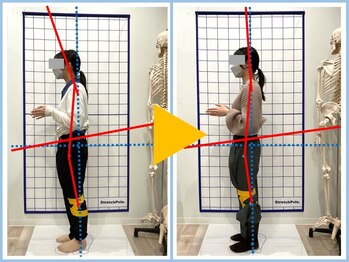 クリア整骨院 仙台東口/施術評価