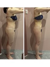 キュール(KuhL)/痩身ビフォーアフター☆