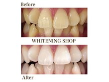 ホワイトニングショップ 山科店の雰囲気(お客様のご要望に合わせた最適なプランをご提案致します◎)