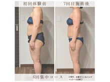 レディジュ 盛岡店(Ladyge)の雰囲気（回数を重ねるごとに実感◎体のサイズみるみる変わる魔法の施術！）