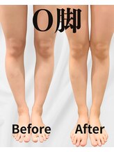 整体院ユールーム 下松店(YOUROOM)/【O脚】