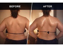 ソバニ(SOBANI)/肩骨はがし　巻き肩・肩凝り