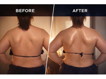 ソバニ(SOBANI)/肩骨はがし　巻き肩・肩凝り