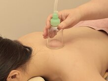 サーズ(SA’S)の雰囲気（カッピングは老廃物の排出、血行不良を積極的にケアできます）
