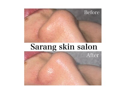 Sarang skin salonの写真