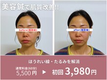 鍼灸Labo アルシア