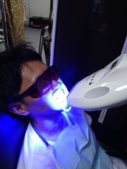 カワウチ健康倶楽部/歯のセルフホワイトニング施術