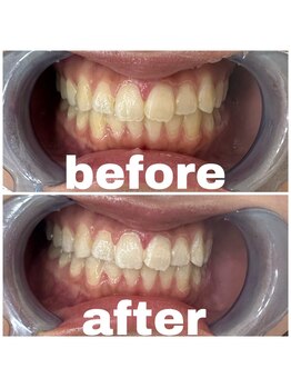 ルナ(LUNA)/20代女性学割初回お試し