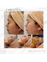 サロン ド ブラン アオヤマ(Salon de BLANC AOYAMA)/CHRISTINAビオフィート