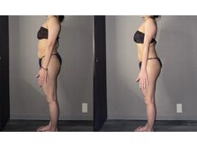 サロンスペース/40代 女性◆全身痩身 1回目